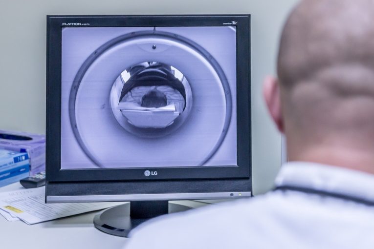 Here’s How To Get An MRI Without Insurance And How Much It
